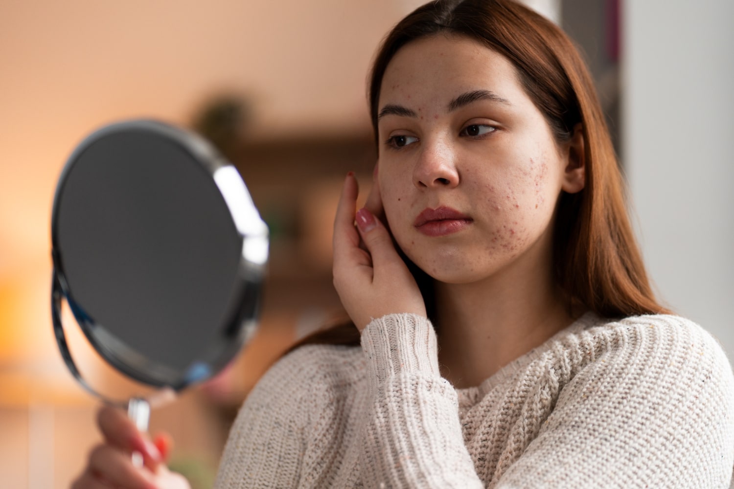 “สิว” (Acne) คือ ภาวะที่รูขุมขนอุดตันจาก ไขมันหรือน้ำมันจากต่อมไขมันส่วนเกิน และเซลล์ผิวที่ตายแล้ว ซึ่งตกค้างอยู่ในรูขุมขน และเมื่อมีแบคทีเรียชนิดหนึ่งเจริญเติบโตในบริเวณที่อุดตันนั้น ก็จะเกิดการอักเสบขึ้น กลายเป็นสิวอักเสบ