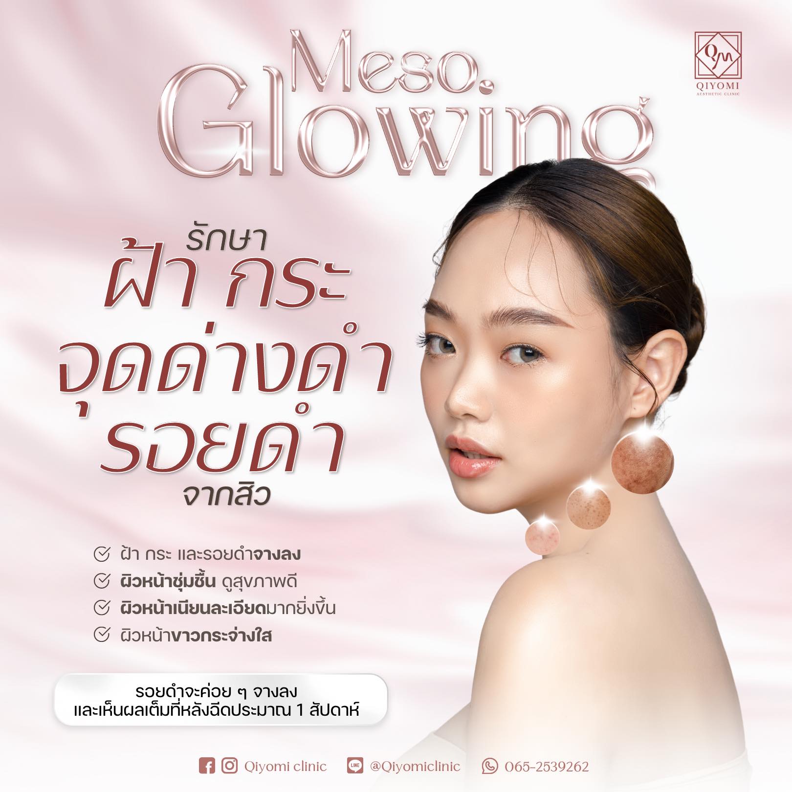 รักษา ฝ้า กระ  เทคโนโลยีทันสมัย ตอบโจทย์ครบทุกความต้องการ เราคัดเทคโนโลยีชั้นนำ มาเพื่อดูแลผิวโดยเฉพาะ เช่น เลเซอร์ที่ช่วยลดเม็ดสีฝ้า กระอย่างตรงจุด, การผลัดผิวด้วยสูตรอ่อนโยน หรือ ผลิตภัณฑ์ดูแลผิวสูตรพิเศษ ที่ช่วยลดรอยอย่างมีประสิทธิภาพ