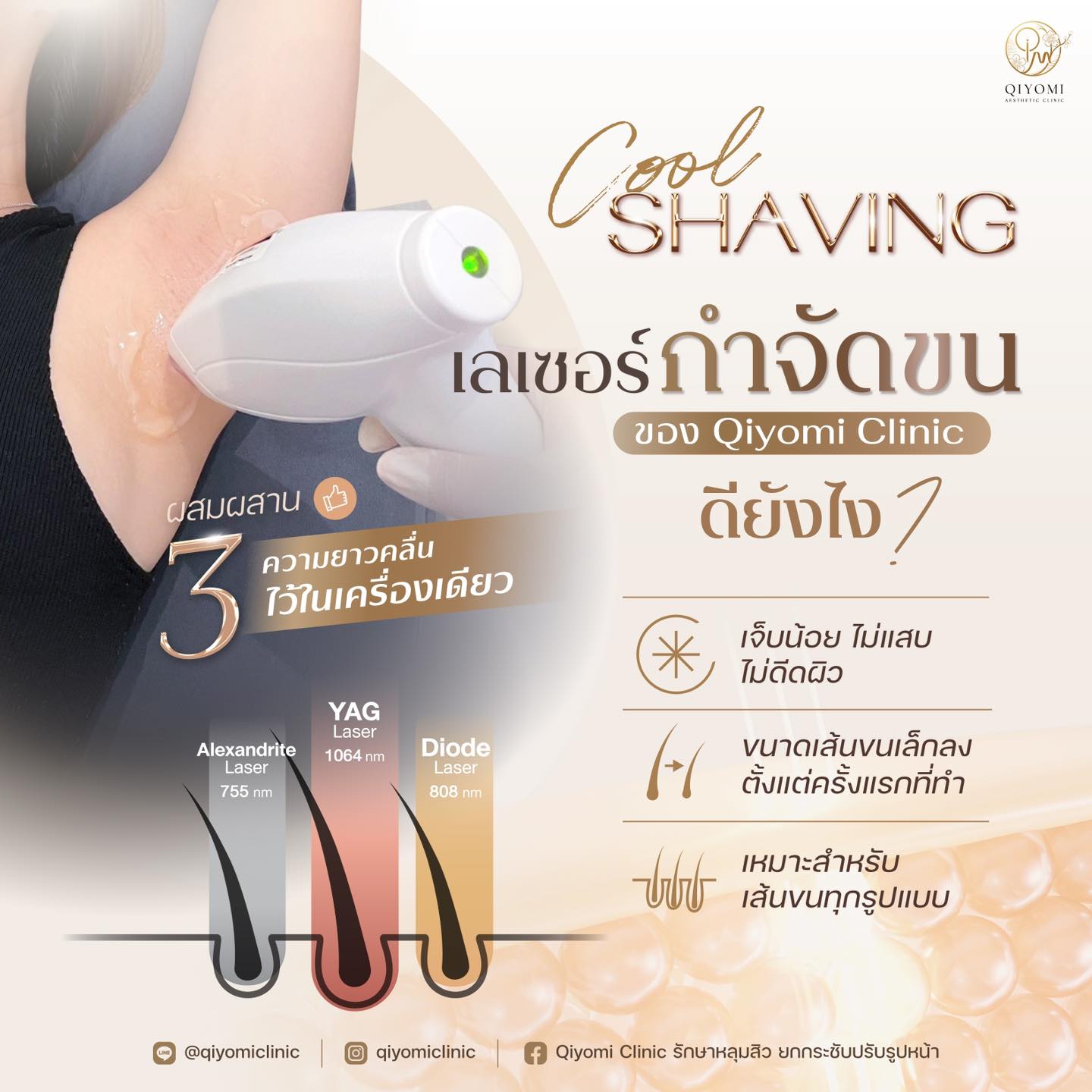 เลเซอร์กำจัดขน ที่คิโยมิคลินิกเราใช้เป็น ไดโอดเลเซอร์ (Diode Laser) ที่ผสาน 3 พลังงานไว้ในเครื่องเดียว ออกแบบมาเพื่อให้การกำจัดขนมีประสิทธิภาพสูงสุด เห็นผลเร็ว เหมาะสำหรับทุกสภาพผิวและทุกประเภทเส้นขน พร้อมถนอมผิวอย่างอ่อนโยน
